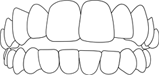 dentadura 2