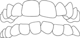 dentadura 4