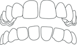 dentadura 5