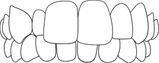 dentadura 6